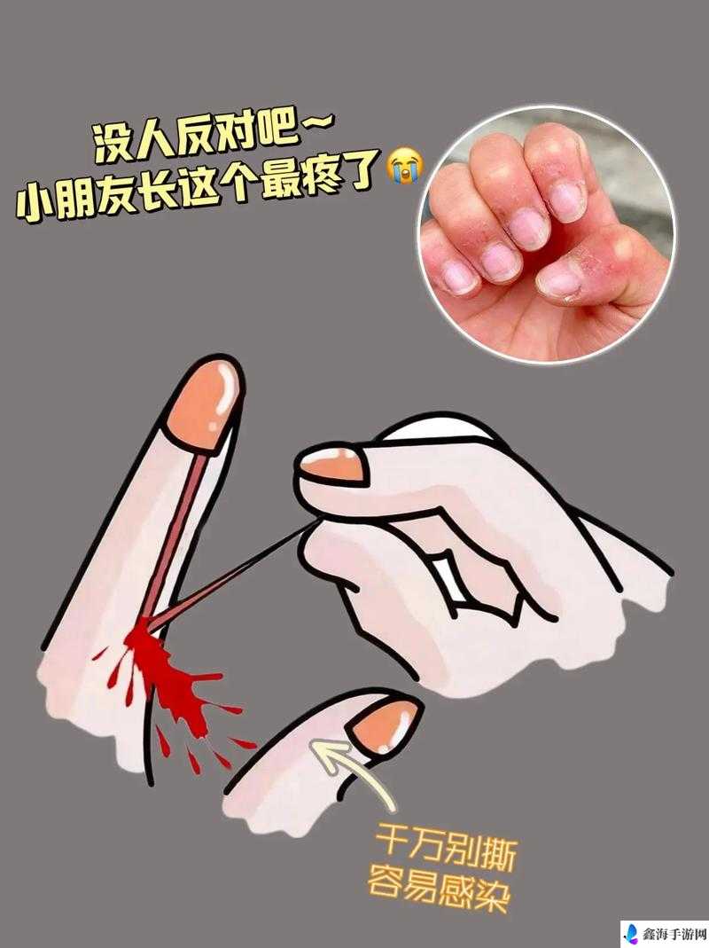 宝宝三根手指痛为何会这样